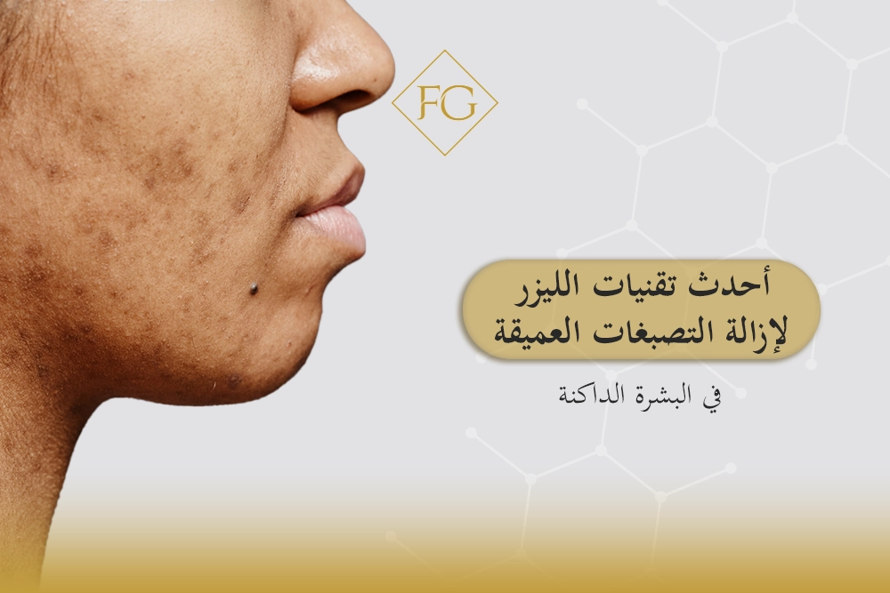 تقنيات الليزر لإزالة التصبغات العميقة