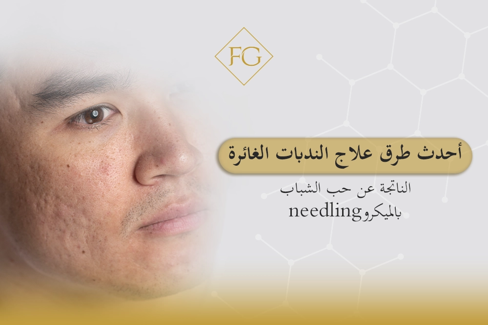 طرق علاج الندبات الغائرة