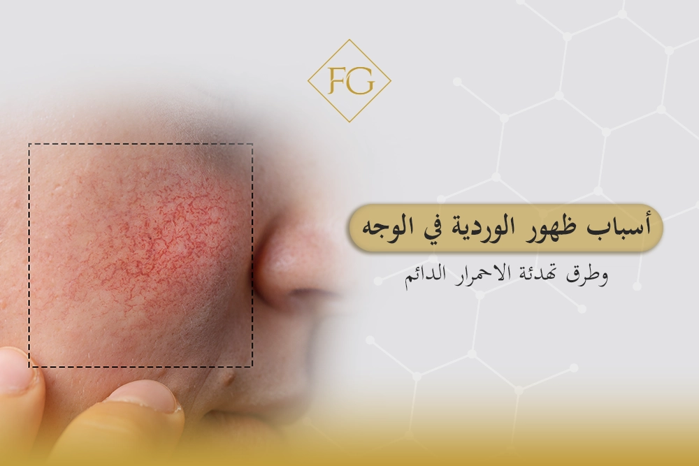 أسباب ظهور الوردية في الوجه