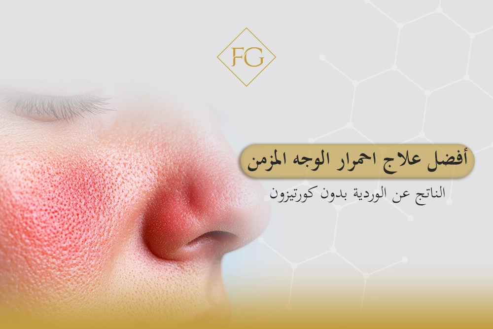 علاج احمرار الوجه المزمن