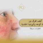 حساسية الوجه والوردية الجلدية