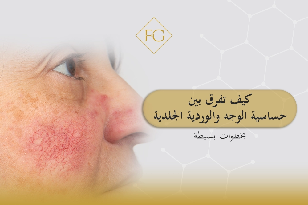 حساسية الوجه والوردية الجلدية