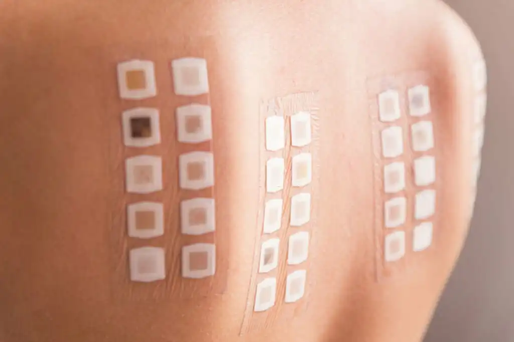 Skin Allergy Test unit