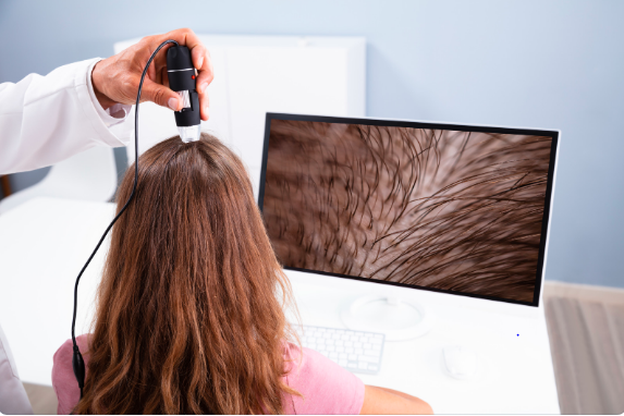 Dermatologist examining patient's hair for hair loss in Dubai