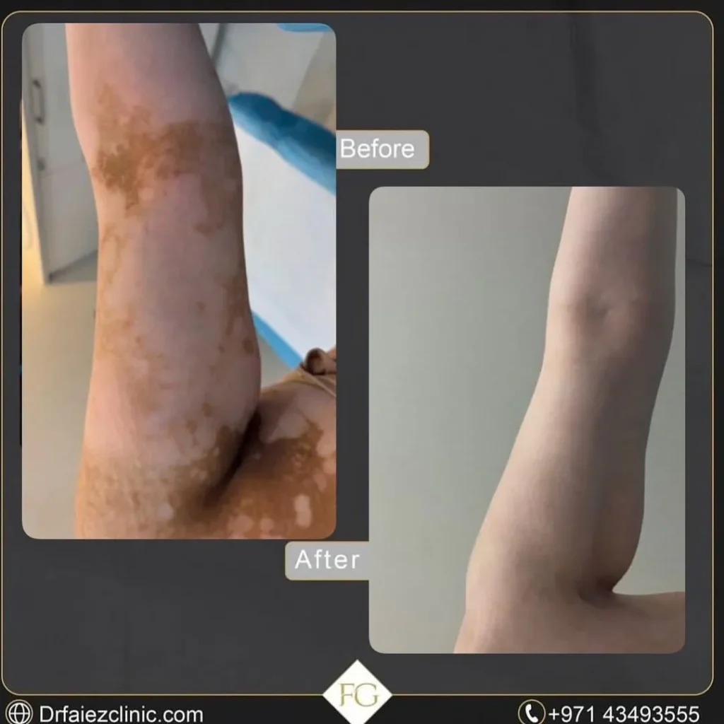 عيادات الجلدية - dermatology clinic