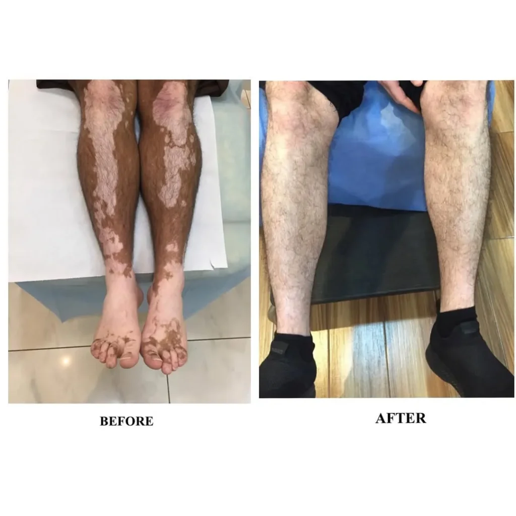 عيادات الجلدية - dermatology clinic