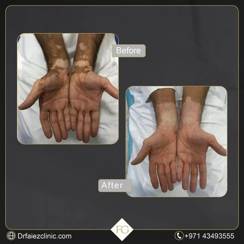 عيادات الجلدية - dermatology clinic