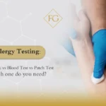 skin prick test vs blood test
