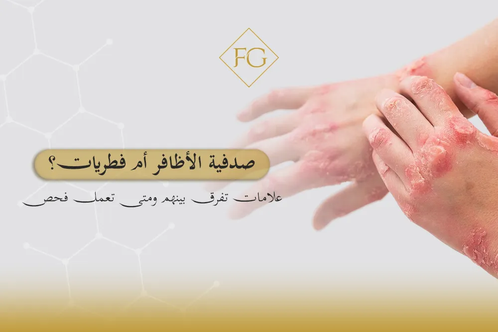 صدفية الأظافر أم فطريات