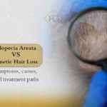 alopecia areata vs androgenetic alopecia