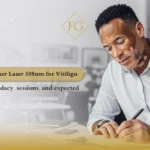 excimer laser for vitiligo