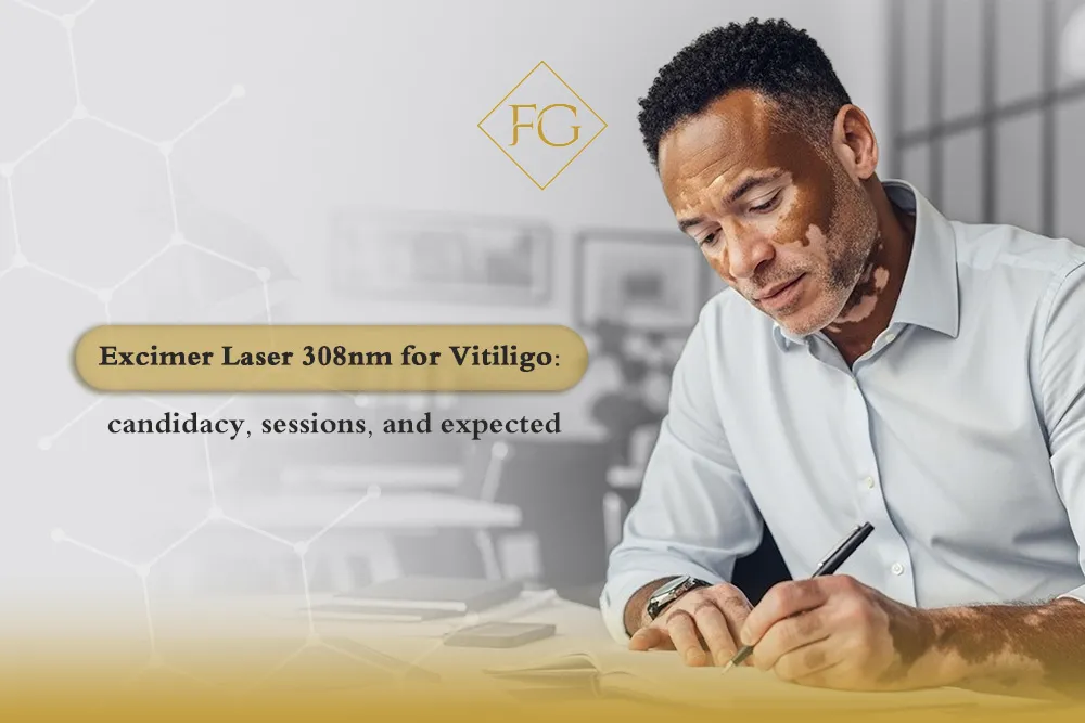 excimer laser for vitiligo