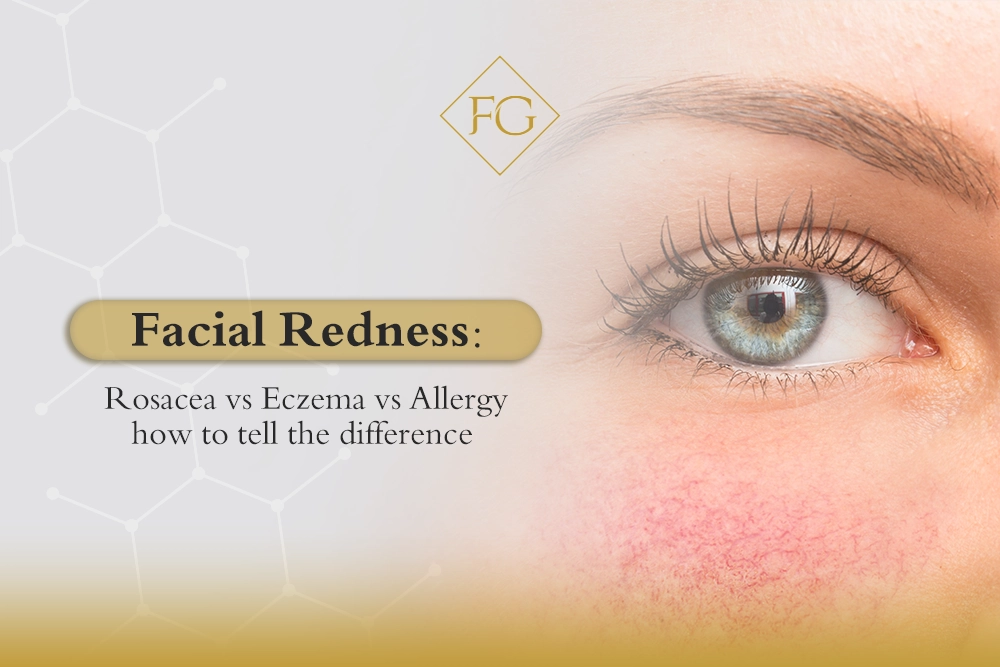 Facial Redness: Rosacea vs Eczema vs Allergy how to tell the difference