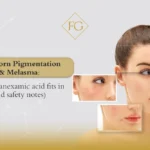 tranexamic acid for melasma