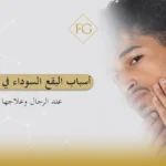 أسباب البقع السوداء في الوجه عند الرجال