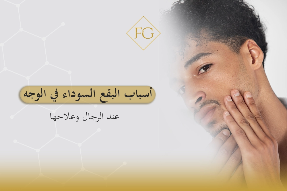 أسباب البقع السوداء في الوجه عند الرجال
