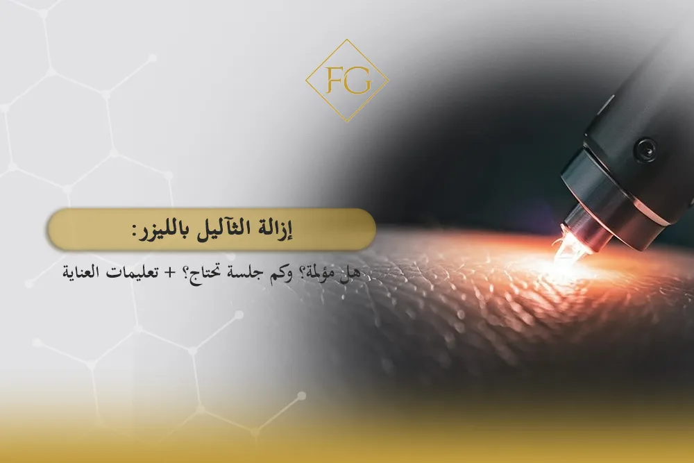 إزالة الثآليل بالليزر