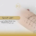 اختبار الحساسية Skin Prick Test ولا تحليل دم