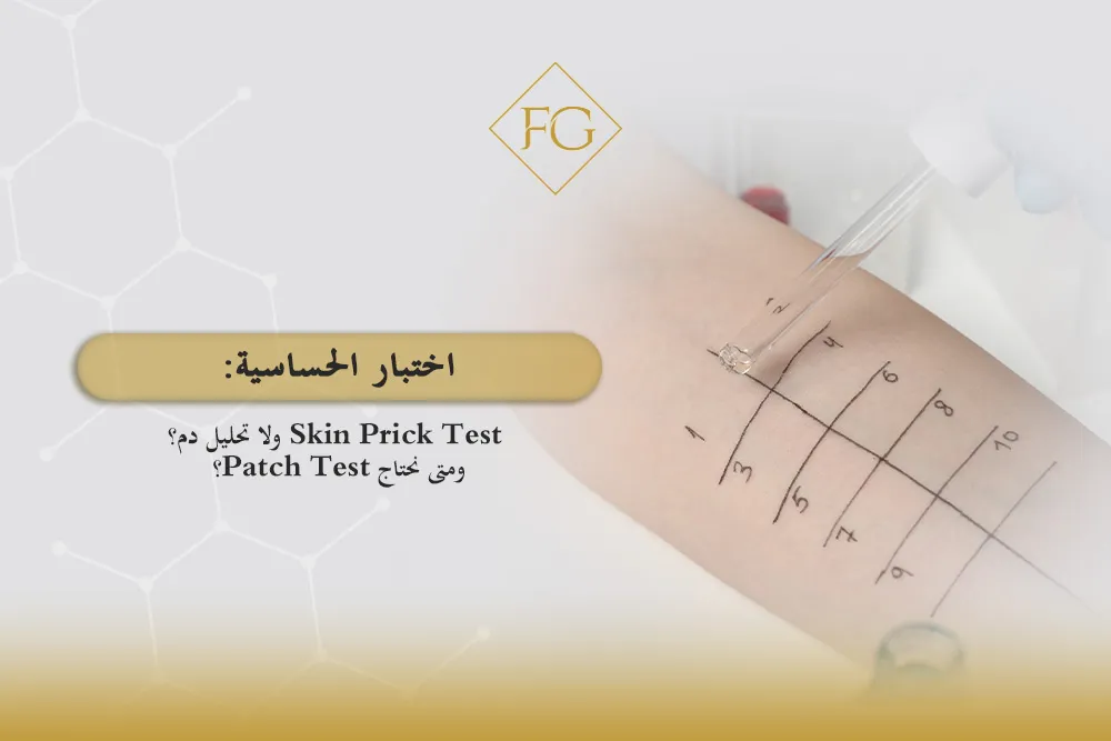 اختبار الحساسية Skin Prick Test ولا تحليل دم