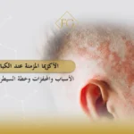 الأكزيما المزمنة عند الكبار