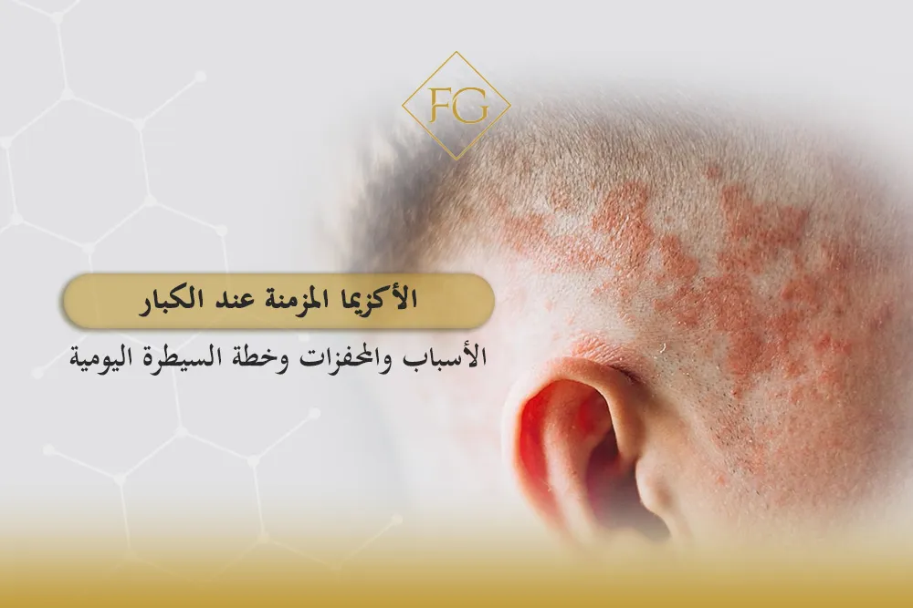 الأكزيما المزمنة عند الكبار