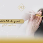 تجربتي مع حقن البلازما للشعر