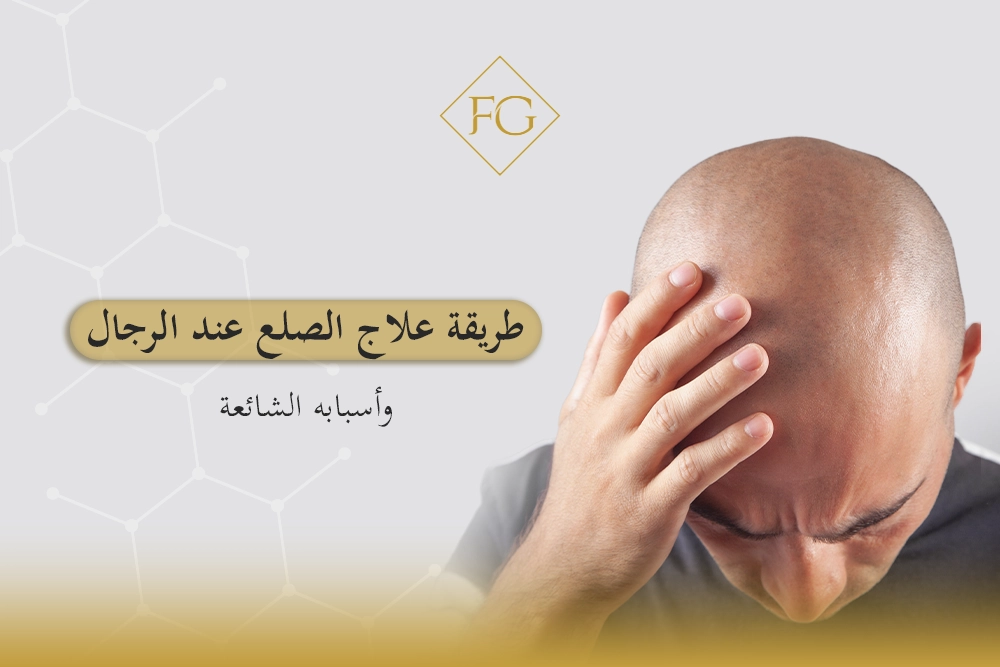 طريقة علاج الصلع عند الرجال
