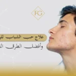 علاج حب الشباب للرجال