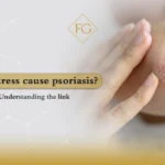 Can stress cause psoriasis