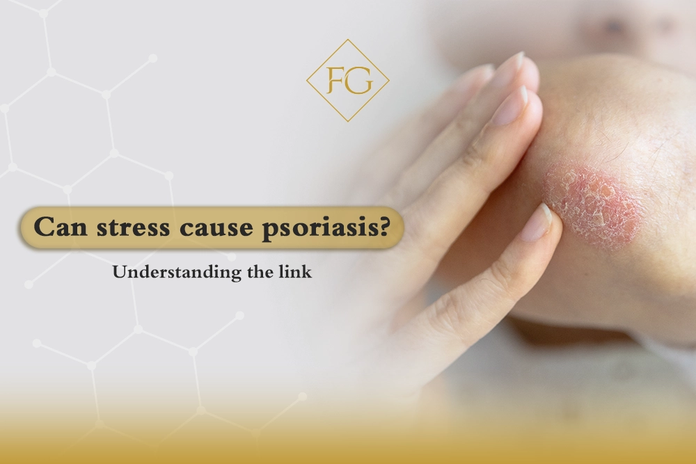 Can stress cause psoriasis