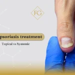Nail psoriasis treatment