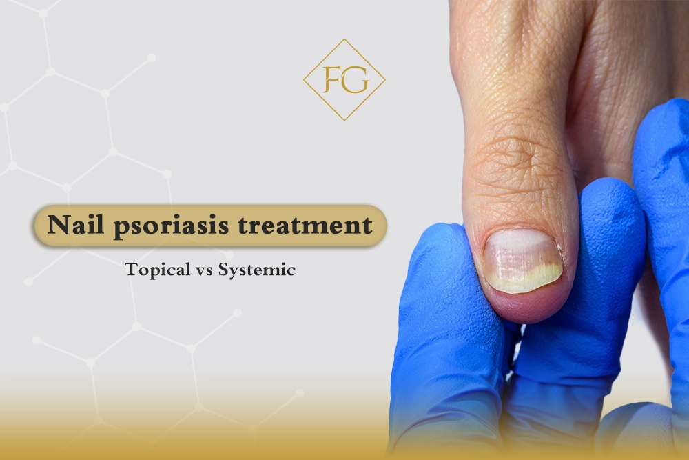 Nail psoriasis treatment