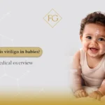 What is vitiligo in babies?