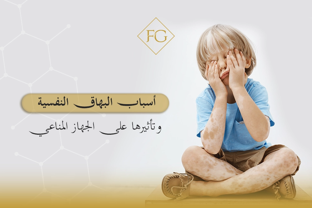 أسباب البهاق النفسية