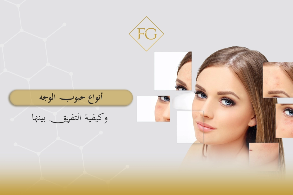 أنواع حبوب الوجه