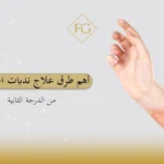 ندبات الحروق من الدرجة الثانية