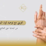 توحيد لون البهاق