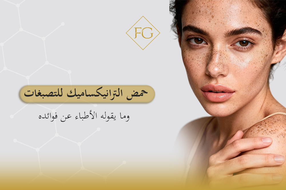 حمض الترانيكساميك للتصبغات