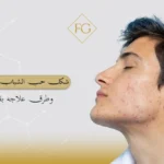 شكل حب الشباب الهرموني