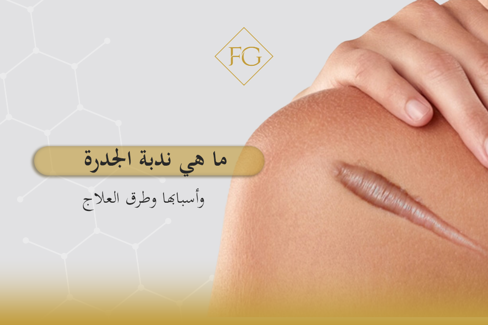 ما هي ندبة الجدرة