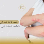 هل الإكزيما تنتشر في الجسم؟