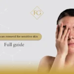 acne scars removal