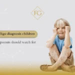 early vitiligo diagnosis children