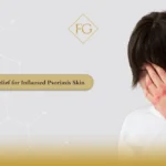 Inflamed Psoriasis Skin