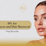 IPL for rosacea near me