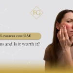 IPL rosacea cost UAE