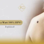 Is a wart 100% HPV