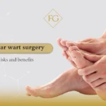 Plantar wart surgery
