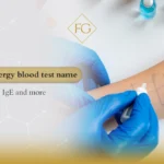 Skin allergy blood test name