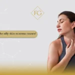 oily skin eczema causes